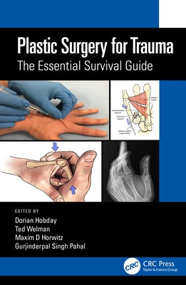 Plastic Surgery for Trauma: The Essential Survival Guide by Hobday, Dorian