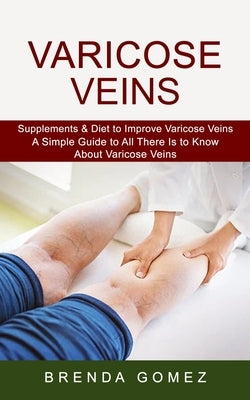 Varicose Veins: Supplements & Diet to Improve Varicose Veins (A Simple Guide to All There Is to Know About Varicose Veins) by Gomez, Brenda