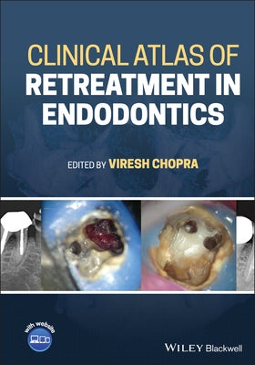 Clinical Atlas of Retreatment in Endodontics by Chopra, Viresh