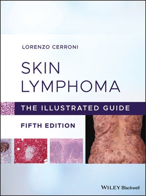 Skin Lymphoma: The Illustrated Guide by Cerroni, Lorenzo