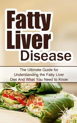 Fatty Liver Disease: The Ultimate Guide for Understanding the Fatty Liver Diet And What You Need to Know by Migan, Wade
