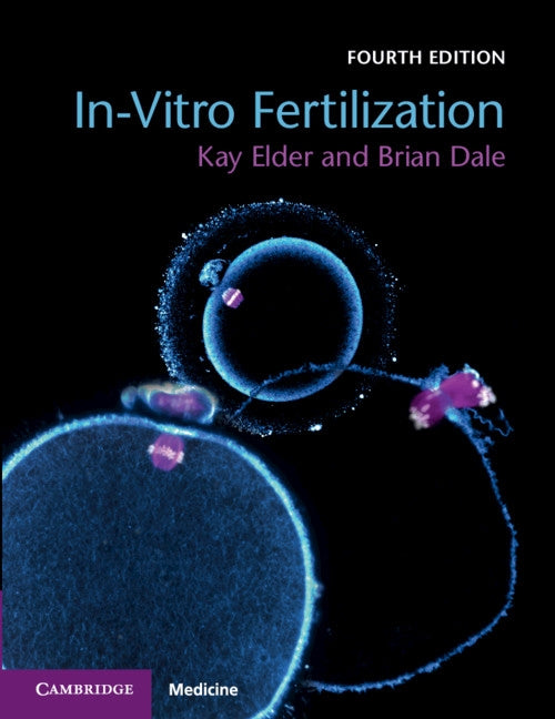 In-Vitro Fertilization by Elder, Kay