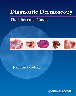 Diagnostic Dermoscopy: The Illustrated Guide by Bowling, Jonathan