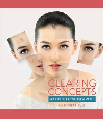 Clearing Concepts: A Guide to Acne Treatment by Lees, Mark