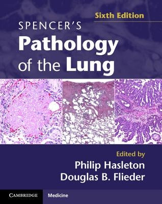 Spencer's Pathology of the Lung 2 Part Set with DVDs [With DVD] by Hasleton, Philip