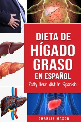 Dieta de hígado graso en español/Fatty liver diet in Spanish by Mason, Charlie