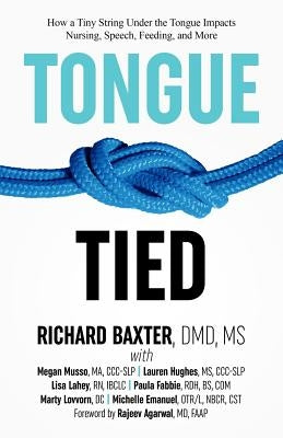 Tongue-Tied: How a Tiny String Under the Tongue Impacts Nursing, Speech, Feeding, and More by Baxter, DMD