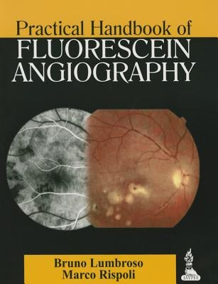 Practical Handbook of Fluorescein Angiography by Lumbroso, Bruno
