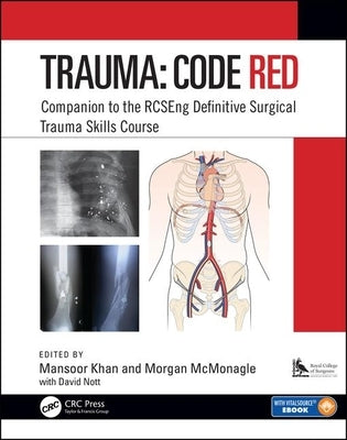 Trauma: Code Red: Companion to the Rcseng Definitive Surgical Trauma Skills Course by Khan, Mansoor
