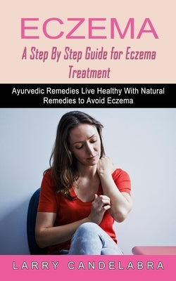 Eczema: A Step By Step Guide for Eczema Treatment (Ayurvedic Remedies Live Healthy With Natural Remedies to Avoid Eczema) by Candelabra, Larry