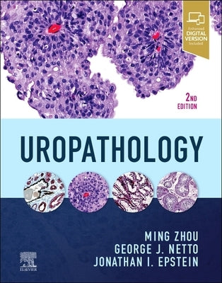 Uropathology by Zhou, Ming