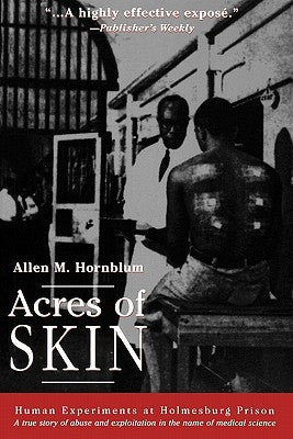 Acres of Skin: Human Experiments at Holmesburg Prison by Hornblum, Allen M.