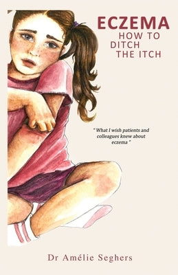 Eczema: How to Ditch the Itch by Seghers, Am&#233;lie