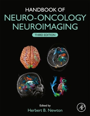 Handbook of Neuro-Oncology Neuroimaging by Newton, Herbert B.