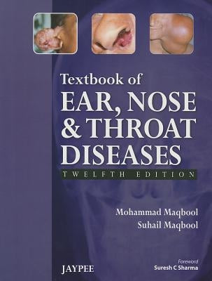 Textbook of Ear, Nose and Throat Diseases by Maqbool, Mohammad