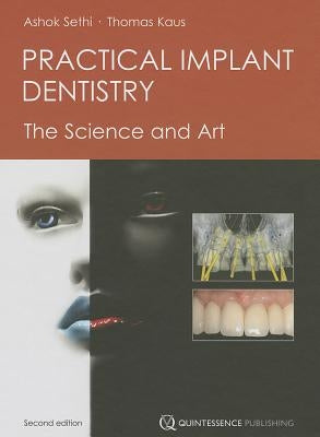 Practical Implant Dentistry: The Science and Art by Sethi, Ashok
