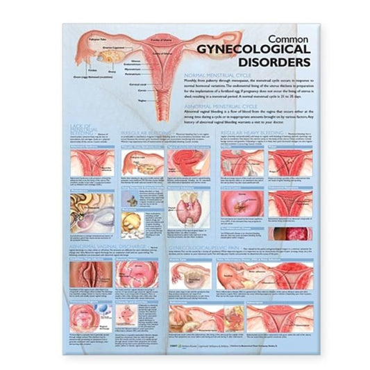Common Gynecological Disorders Anatomical Chart by Anatomical Chart Company