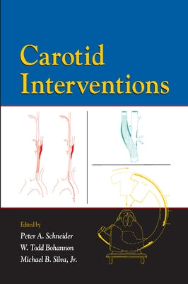 Carotid Interventions by Schneider, Peter