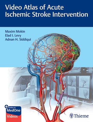 Video Atlas of Acute Ischemic Stroke Intervention by Mokin, Maxim