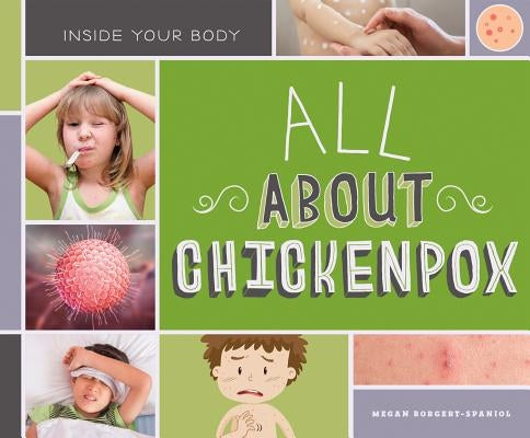 All about Chickenpox by Borgert-Spaniol, Megan