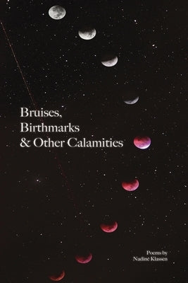 Bruises, Birthmarks & Other Calamities by Klassen, Nadine