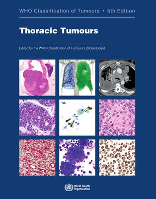 Thoracic Tumours: Who Classification of Tumours by Who Classification of Tumours Editorial