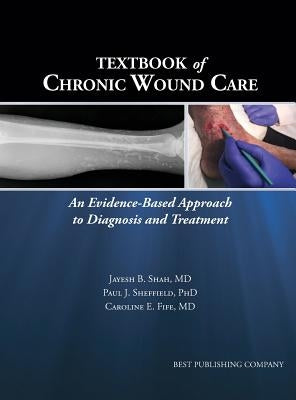 Textbook of Chronic Wound Care: An Evidence-Based Approach to Diagnosis Treatment by Shah, Jayesh B.