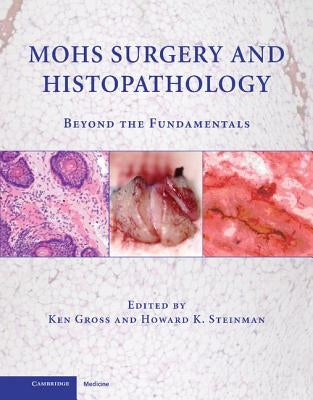 Mohs Surgery and Histopathology: Beyond the Fundamentals by Gross, Ken