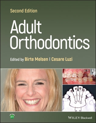 Adult Orthodontics by Melsen, Birte