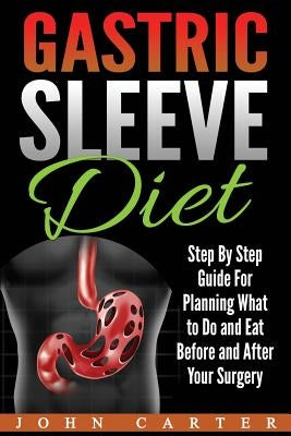 Gastric Sleeve Diet: Step By Step Guide For Planning What to Do and Eat Before and After Your Surgery by Carter, John