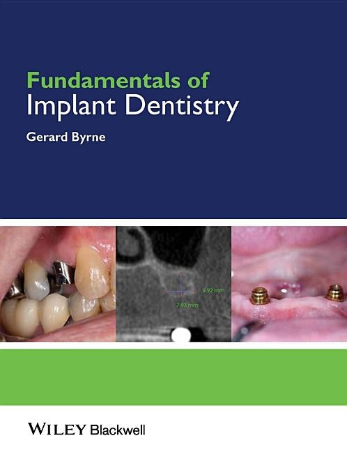 Fundamentals of Implant Dentistry by Byrne, Gerard