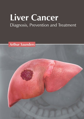 Liver Cancer: Diagnosis, Prevention and Treatment by Saunders, Arthur