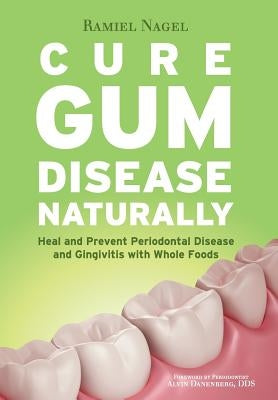 Cure Gum Disease Naturally: Heal Gingivitis and Periodontal Disease with Whole Foods by Nagel, Ramiel