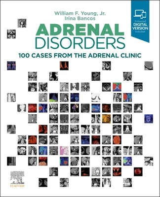 Adrenal Disorders: 100 Cases from the Adrenal Clinic by Young, William F.