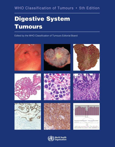 Digestive System Tumours: Who Classification of Tumours by Who Classification of Tumours Editorial