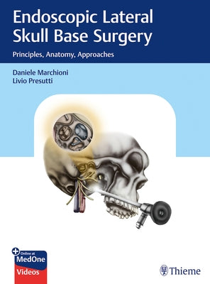 Endoscopic Lateral Skull Base Surgery: Principles, Anatomy, Approaches by Marchioni, Daniele