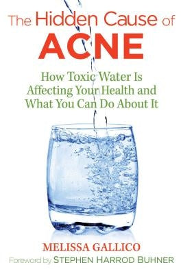 The Hidden Cause of Acne: How Toxic Water Is Affecting Your Health and What You Can Do about It by Gallico, Melissa