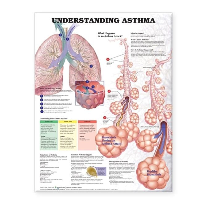 Understanding Asthma Anatomical Chart by Anatomical Chart Company