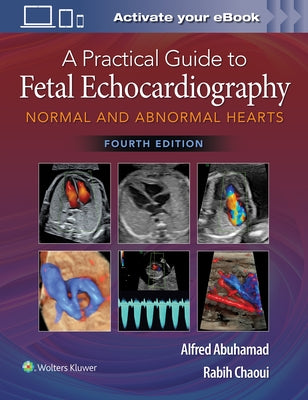 A Practical Guide to Fetal Echocardiography: Normal and Abnormal Hearts by Abuhamad, Alfred Z.