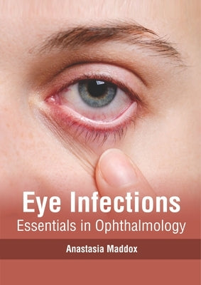 Eye Infections: Essentials in Ophthalmology by Maddox, Anastasia
