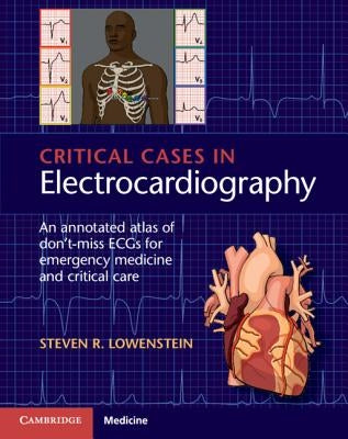 Critical Cases in Electrocardiography: An Annotated Atlas of Don't-Miss Ecgs for Emergency Medicine and Critical Care by Lowenstein, Steven R.