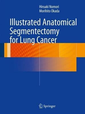 Illustrated Anatomical Segmentectomy for Lung Cancer by Nomori, Hiroaki