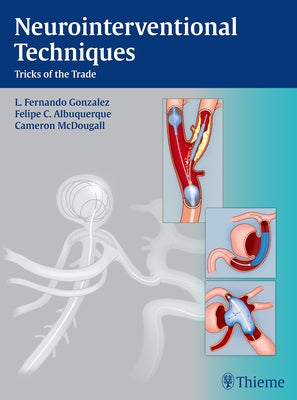 Neurointerventional Techniques: Tricks of the Trade by Gonzalez, Fernando