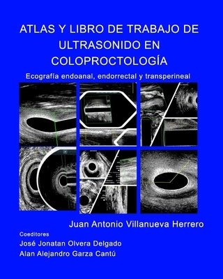 Atlas y Libro de Trabajo de Ultrasonido en Coloproctología: Ecografia endoanal, endorrectal y transperineal by Herrero, Juan a. Villanueva