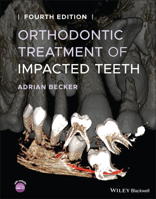 Orthodontic Treatment of Impacted Teeth by Becker, Adrian