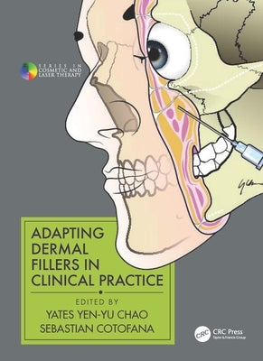 Adapting Dermal Fillers in Clinical Practice by Chao, Yates Yen-Yu
