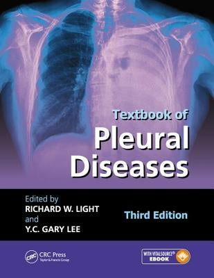 Textbook of Pleural Diseases by Light, Richard W.