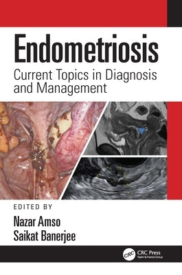 Endometriosis: Current Topics in Diagnosis and Management by Amso, Nazar