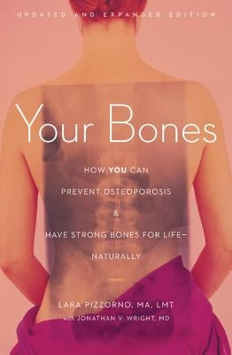 Your Bones: How You Can Prevent Osteoporosis & Have Strong Bones for Life - Naturally by Pizzorno, Lara