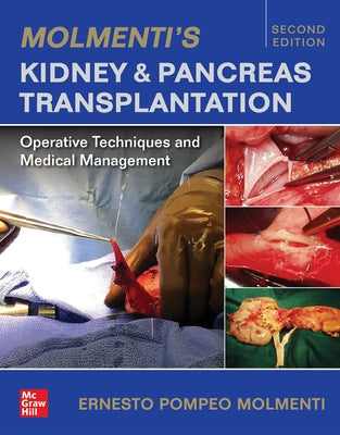 Molmenti's Kidney and Pancreas Transplantation: Operative Techniques and Medical Management by Molmenti, Ernesto P.